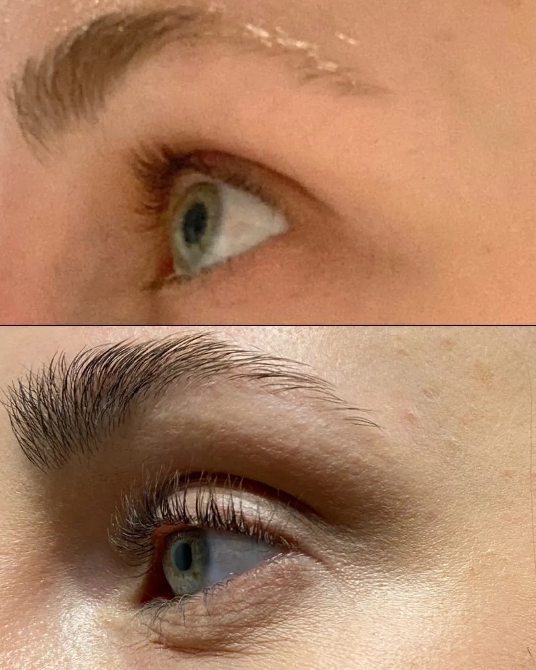 Lenoites® Eyelash Activating Serum