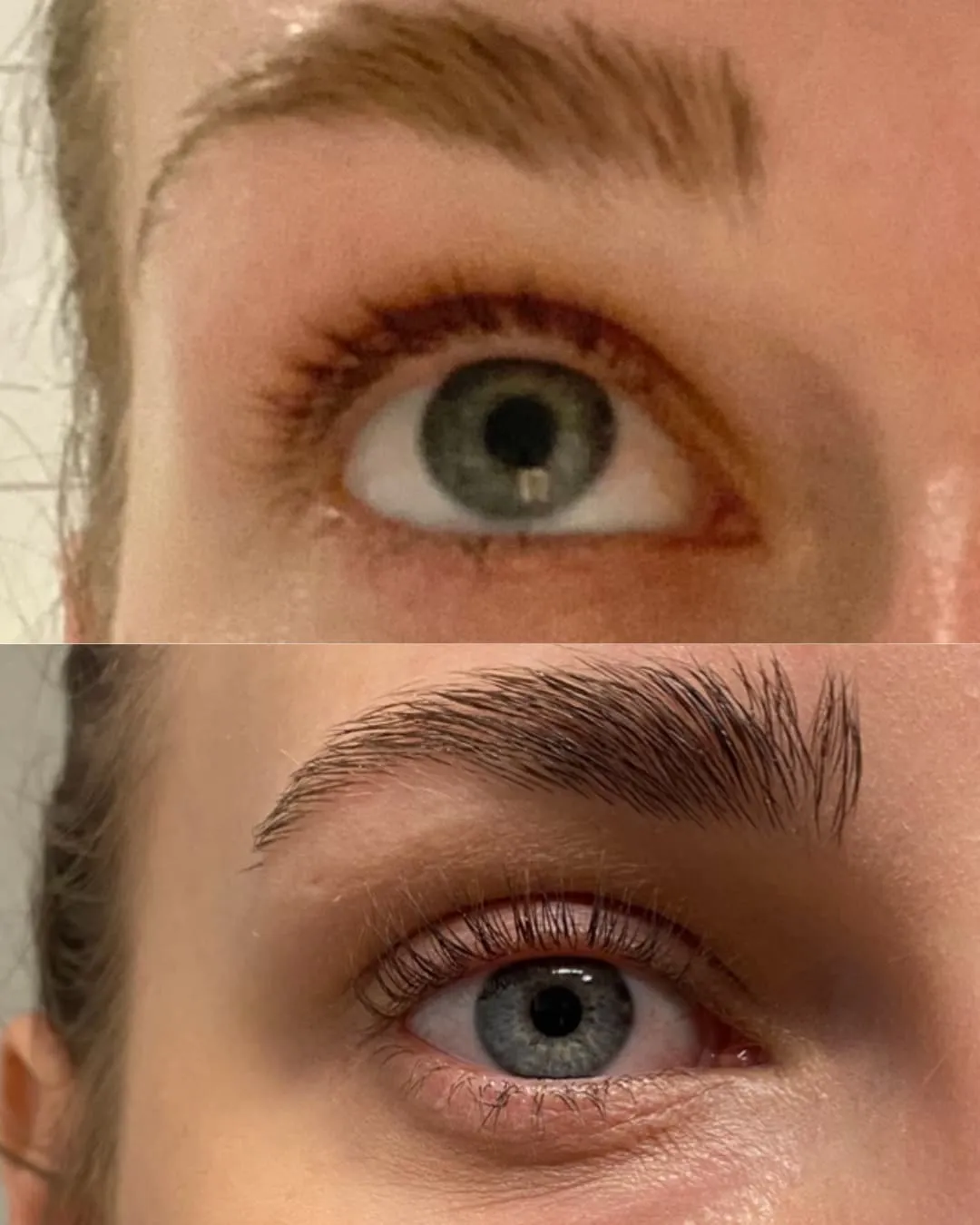 Lenoites® Eyelash Activating Serum