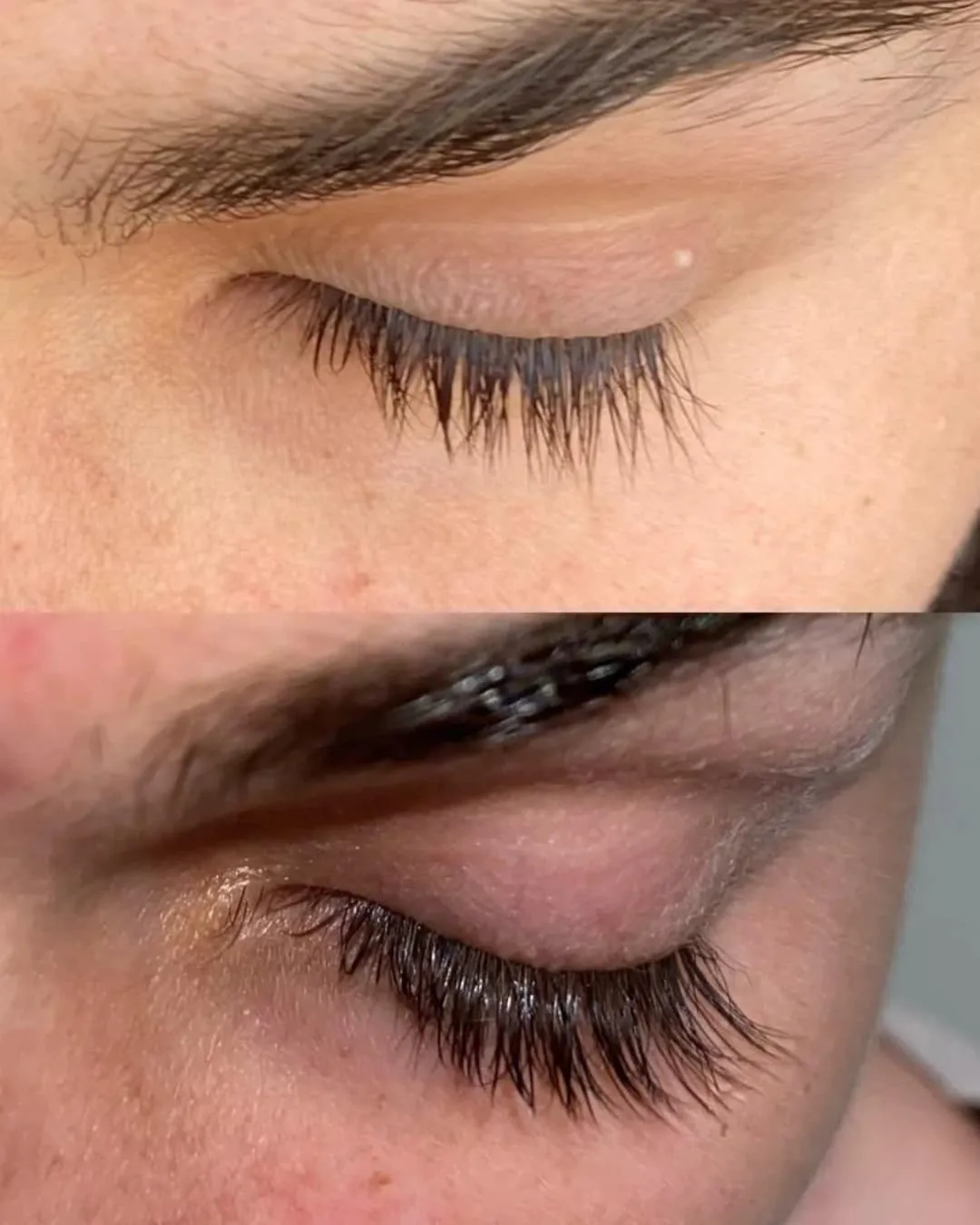 Lenoites® Eyelash Activating Serum
