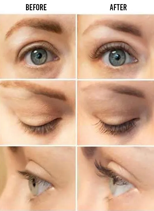 Lenoites® Eyelash Activating Serum