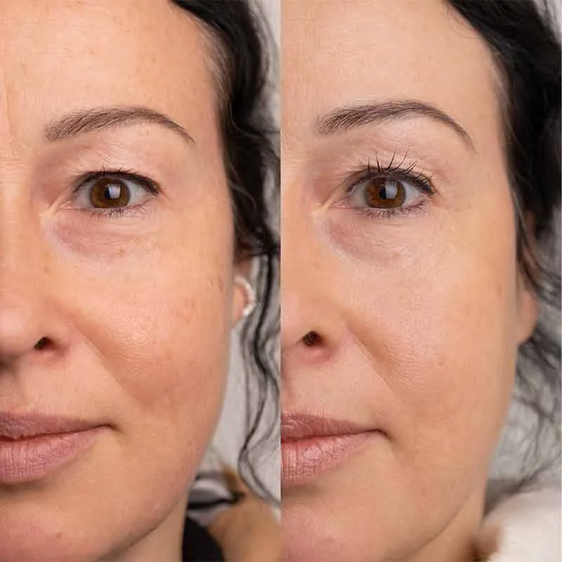 SWEED Pro Lash Growth Serum