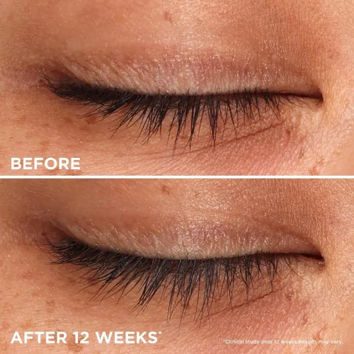 Whoop Lash Serum